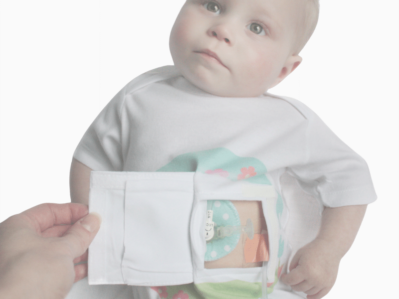 Feeding Tube Friendly Bodysuit Tubesies Feeding Tube Friendly Bodysuit Tubesies